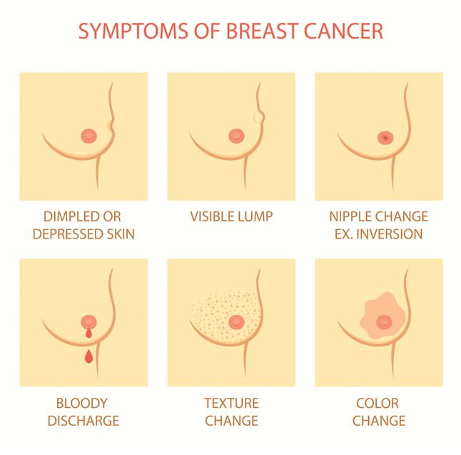 Image Result For Breast Cancer