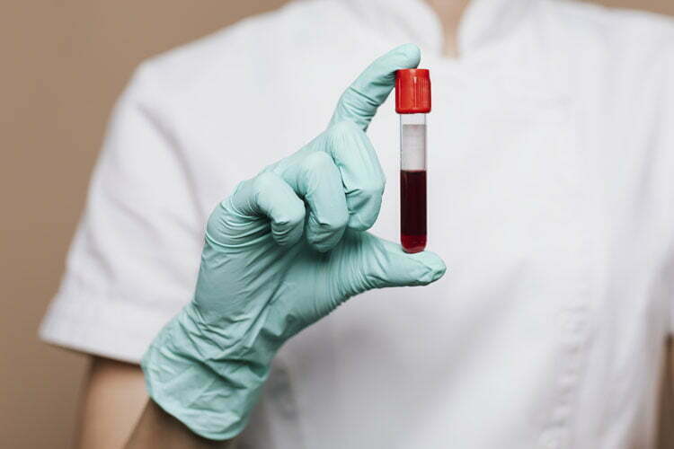 Nurse-holding-a-blood-test-tube-leukemia -beacon-hospital-malaysia