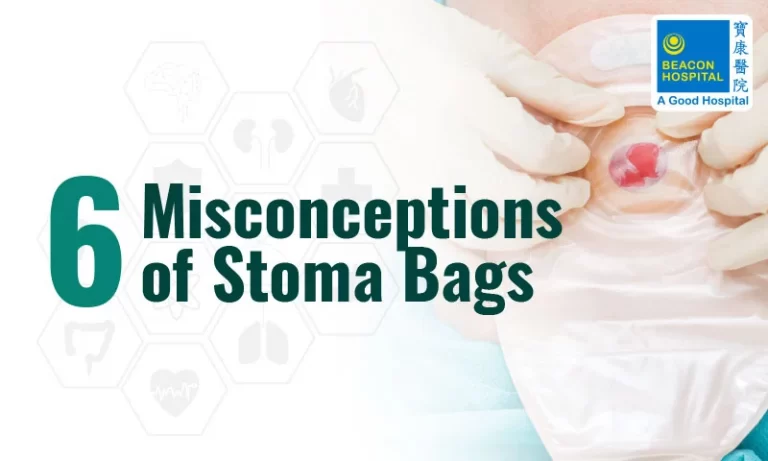 6-Misconceptions-of-Stoma-Bags-wound-and-enterostomal-services-Beacon-Hospital-Malaysia