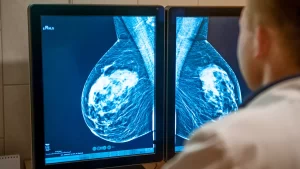 breast cancer scan