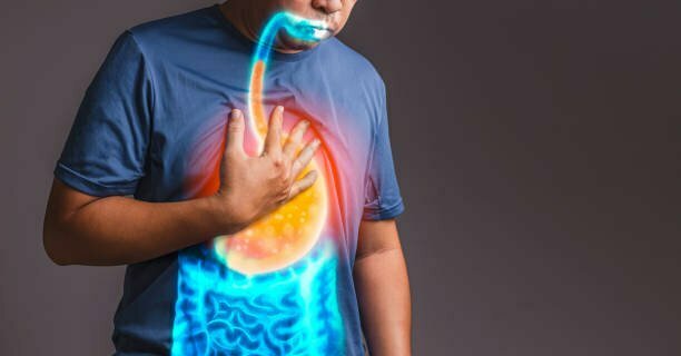 Heartburn? Acid Reflux? What’s the Difference?