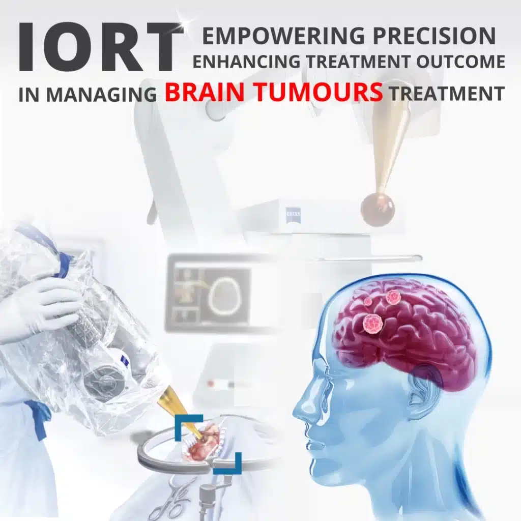 brain tumour cancer treatment, zeiss machine for IORT, intraoperative radiotherapy