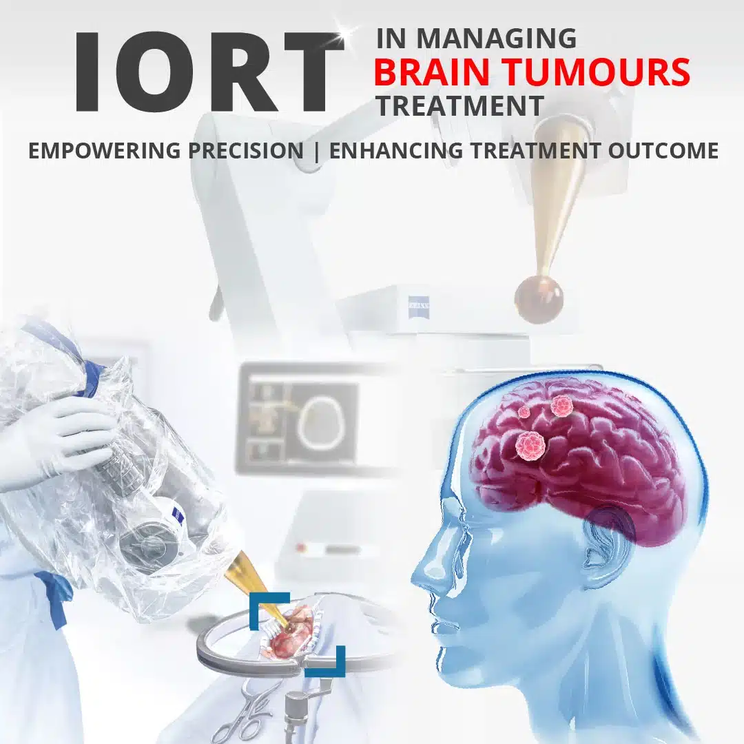 brain tumour cancer treatment, zeiss machine for IORT, intraoperative radiotherapy