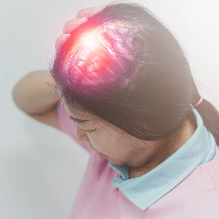 apa-itu-kanker-glioblastoma