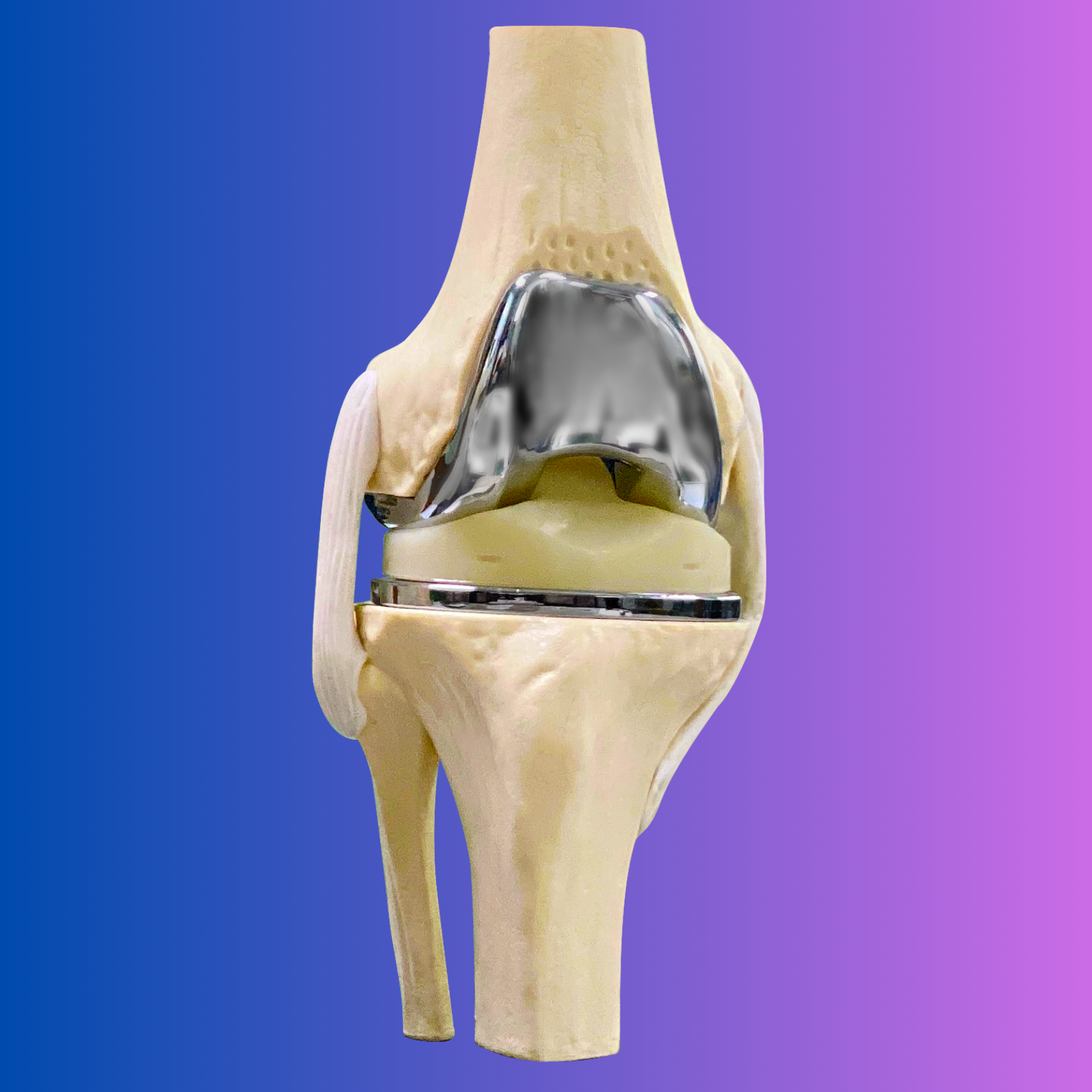 Knee-After-Total-Knee-Replacement-Surgery