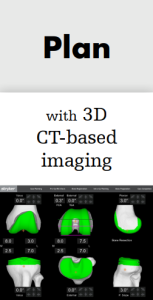 Plan - Personalised Surgical Planning