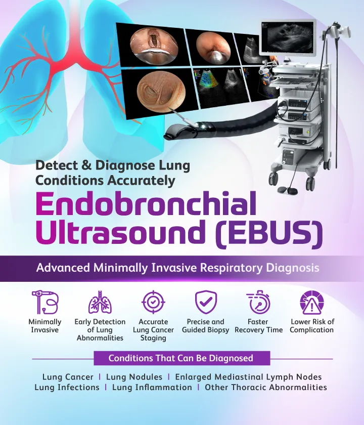 Endobronchial Ultrasound (EBUS)