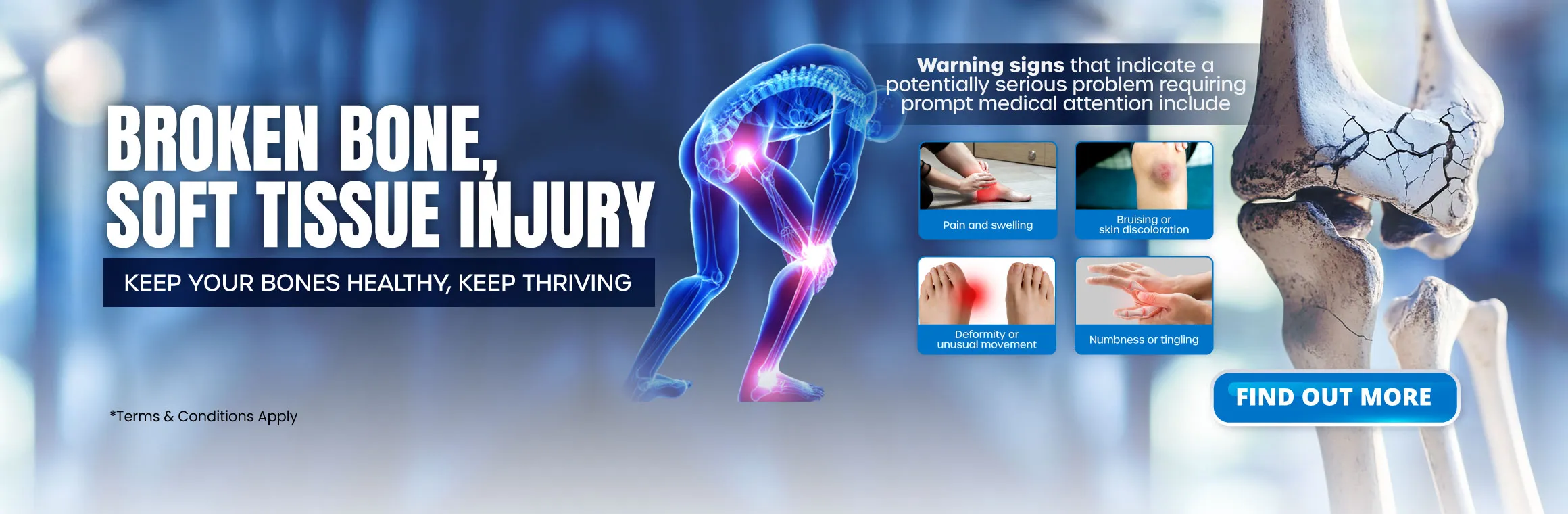 Broken Bone & Soft Tissue Injury