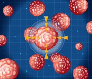 Cancer cells and SBRT treatment illustration